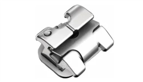 金属托槽矫正 金属托槽矫正