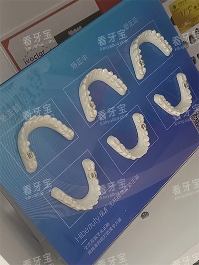 隐秀隐形牙齿矫正 隐秀隐形牙齿矫正