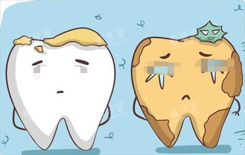 烂牙齿动画形象展示图 烂牙齿动画形象展示图