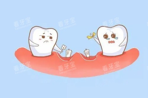 牙齿缺失卡通图 牙齿缺失卡通图