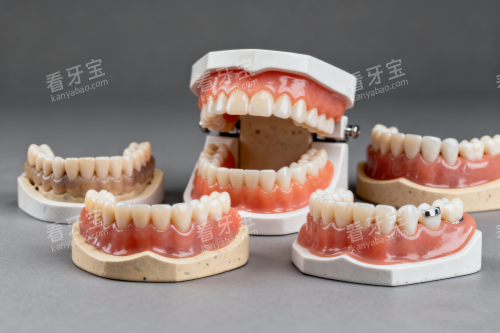 假牙模型图片展示 假牙模型图片展示
