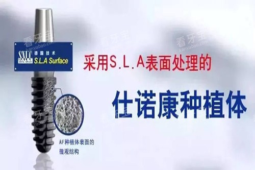 仕诺康种植牙宣传.jpg 仕诺康种植牙宣传.jpg