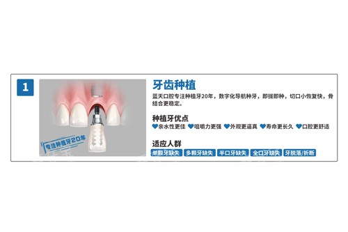 蓝天口腔种植牙优势图.jpg 蓝天口腔种植牙优势图.jpg