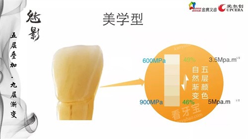 爱尔创全瓷牙魅影美学型.jpg 爱尔创全瓷牙魅影美学型.jpg