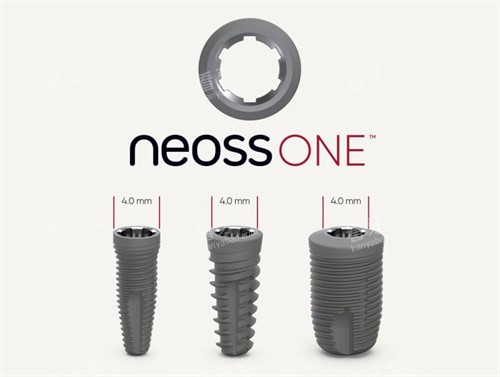Neoss种植牙.jpg Neoss种植牙.jpg