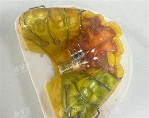 粘接式扩弓器外观.jpg 粘接式扩弓器外观.jpg