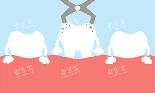 拔除龋齿展示.jpg 拔除龋齿展示.jpg