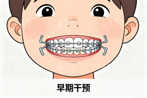 儿牙早期干预卡通图.png 儿牙早期干预卡通图.png