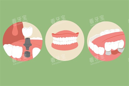 缺牙修复方式.jpg 缺牙修复方式.jpg