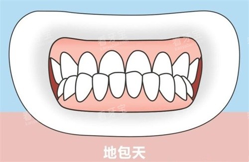 ذʾͼ