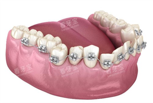 ݶʾͼ