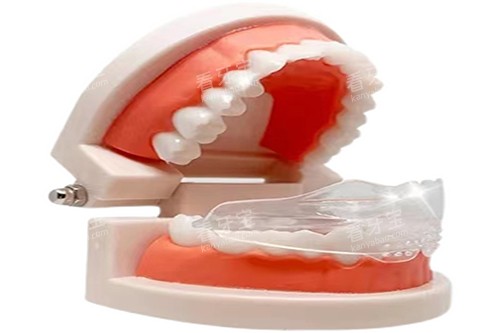 牙齿早期矫正模型 牙齿早期矫正模型