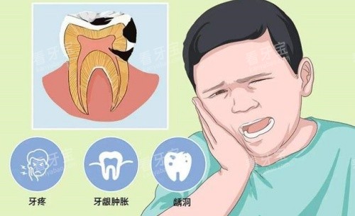 牙齿疾病示意图 牙齿疾病示意图