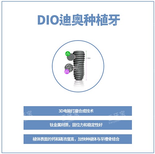 DIOֲͼ