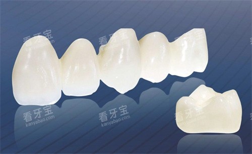 国产牙冠 800 元起,进口牙冠 8000 元起:差距真的值回差价吗?内行人说实话