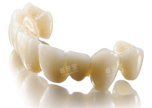 lava全瓷牙连桥冠 lava全瓷牙连桥冠