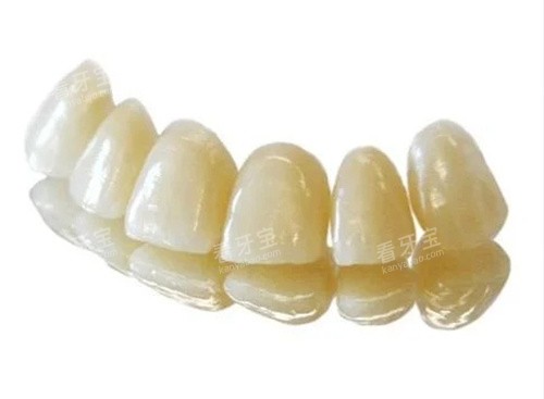 lava全瓷牙牙冠 lava全瓷牙牙冠