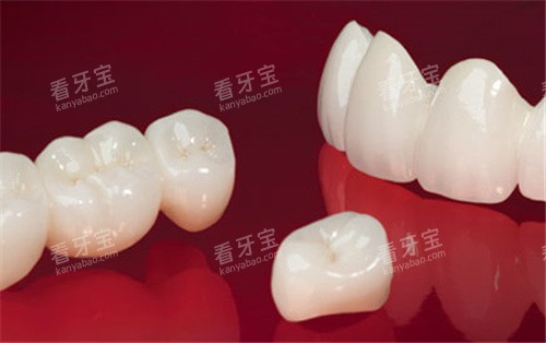 lava全瓷牙展示 lava全瓷牙展示