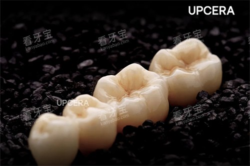 爱尔创-瓷倍健全瓷牙 爱尔创-瓷倍健全瓷牙
