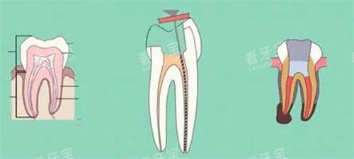 泸州大医大象口腔 2025 价格表查询:种植牙 1880 元起、牙齿矫正 5800 元起、洗牙 33 元起