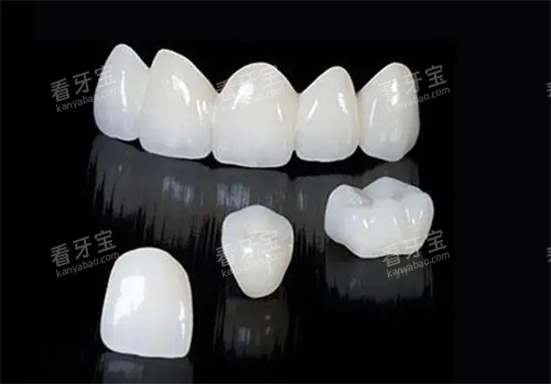纠结威兰德和泽康全瓷牙选哪个?从材质到价格多方位对比给你答案!