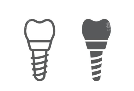 种植牙logo图示意图 种植牙logo图示意图