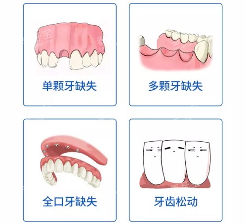 单颗多颗全口牙齿缺失及牙齿松动漫画图 单颗多颗全口牙齿缺失及牙齿松动漫画图