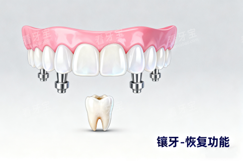镶牙卡通图片一览 镶牙卡通图片一览