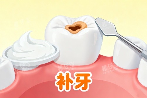 补牙卡通展示一览 补牙卡通展示一览