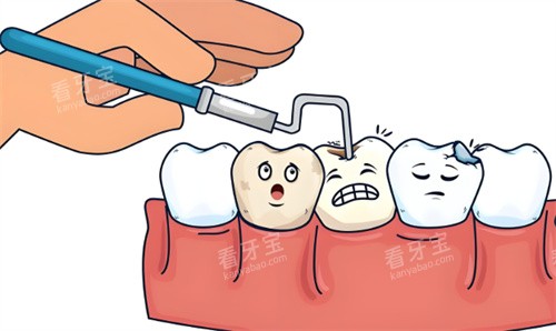 补牙手术项目动画 补牙手术项目动画
