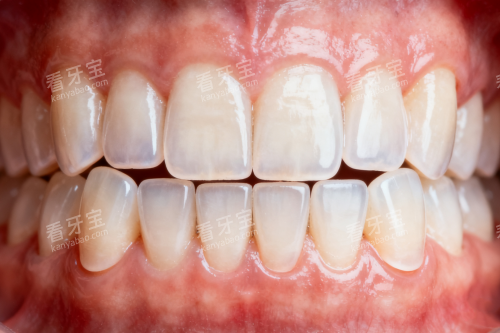 干净整洁牙齿卡通图 干净整洁牙齿卡通图