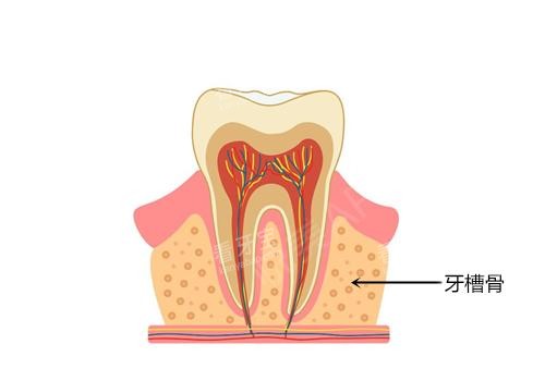 牙槽骨示意图 牙槽骨示意图