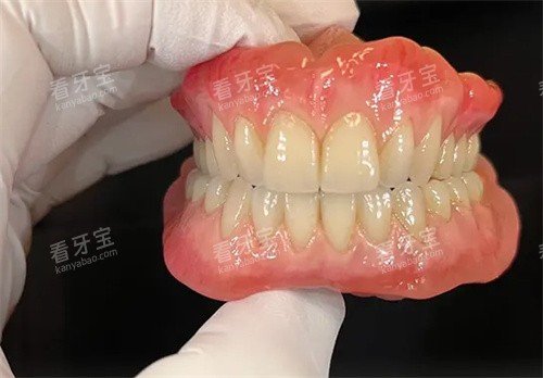 成品吸附性义齿 成品吸附性义齿