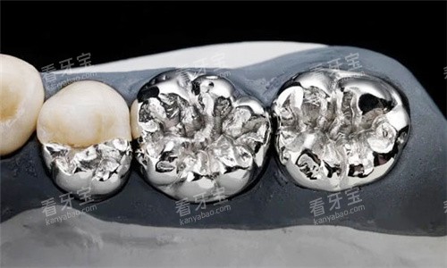 烤瓷牙素材图片 烤瓷牙素材图片