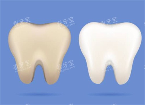 牙齿美白前后图 牙齿美白前后图