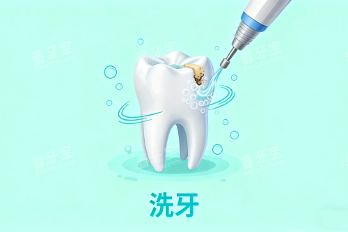 洗牙卡通展示图 洗牙卡通展示图