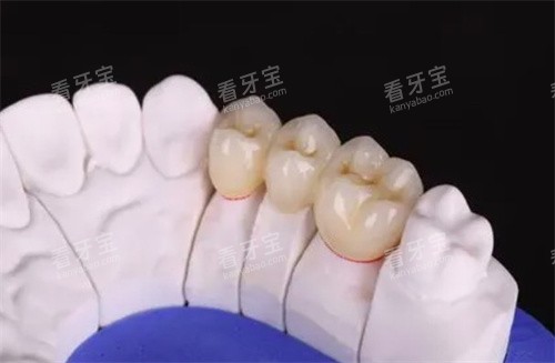 1500-4000Ԫ/ţȫ1200-8000Ԫ/ţһ˵۸