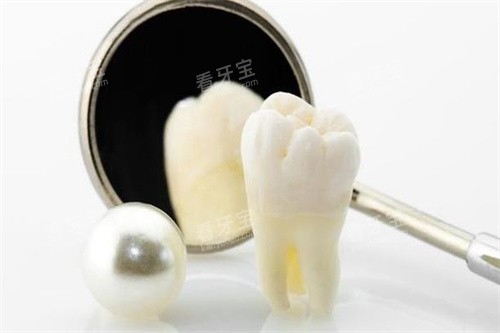 假牙模型细节图 假牙模型细节图