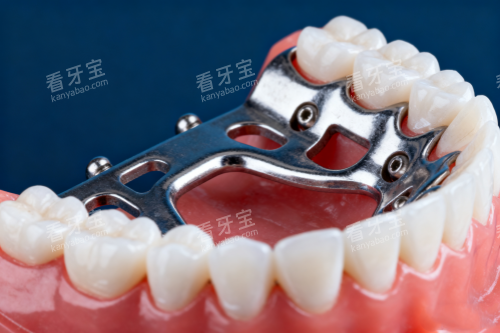 全口假牙模型展示 全口假牙模型展示