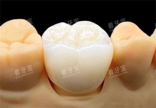 泽康全瓷冠 泽康全瓷冠