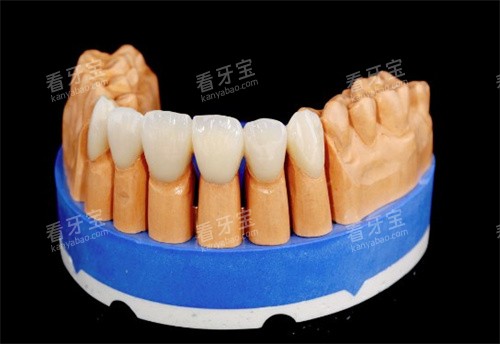 泽康二代全瓷牙 泽康二代全瓷牙