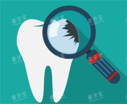 牙齿检查图 牙齿检查图