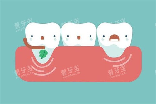 牙齿治疗过程卡通图 牙齿治疗过程卡通图