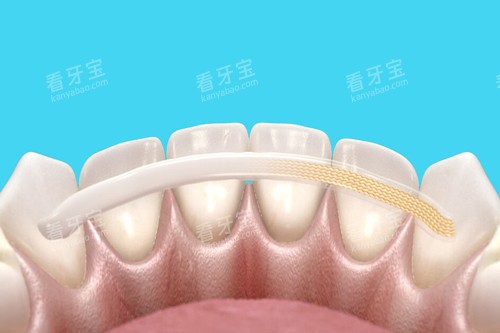 牙齿固定卡通图 牙齿固定卡通图