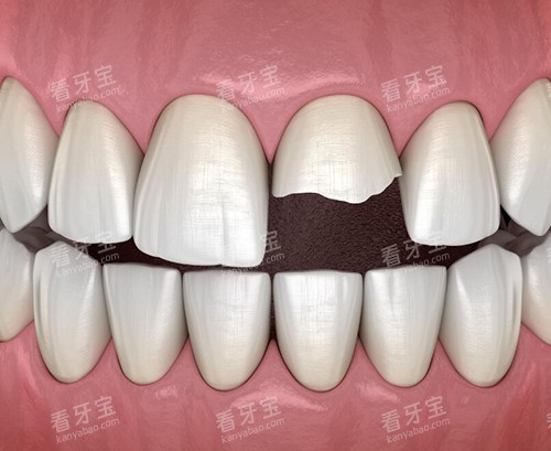 阳东爱牙口腔正规吗?位置在哪?本地正规牙科|整牙水平高服务好,附地址查询