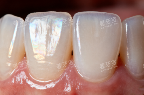 健康正常牙齿卡通图 健康正常牙齿卡通图