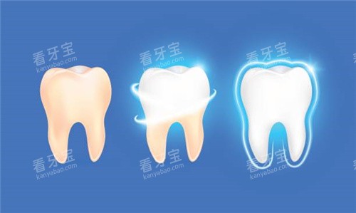 牙齿清洗后变白 牙齿清洗后变白