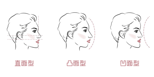 牙齿矫正面型问题 牙齿矫正面型问题