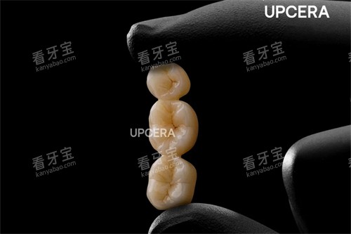 瓷倍健(爱尔创) 瓷倍健(爱尔创)