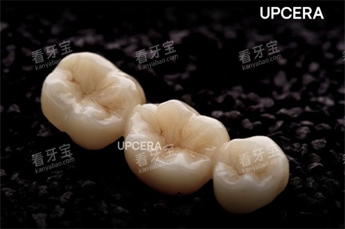爱尔创-瓷倍健全瓷冠 爱尔创-瓷倍健全瓷冠